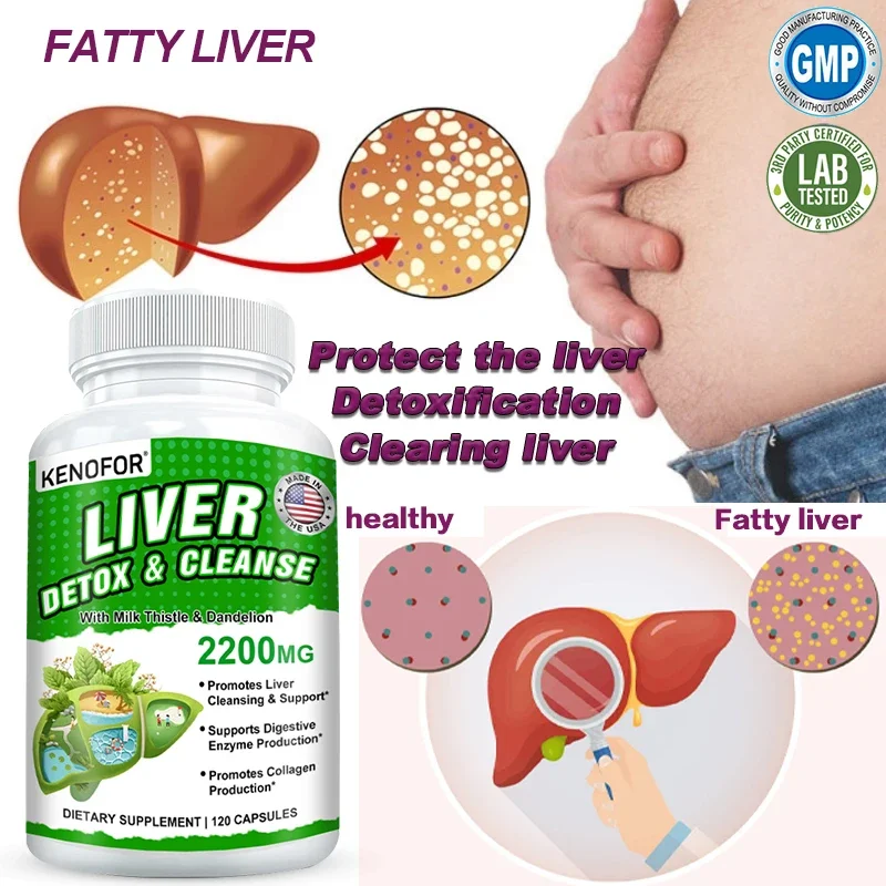 Fatty Liver Cleanse and Liver Detox Supplement - with Turmeric, Milk Thistle and Dandelion for Men Women To Support Liver Health