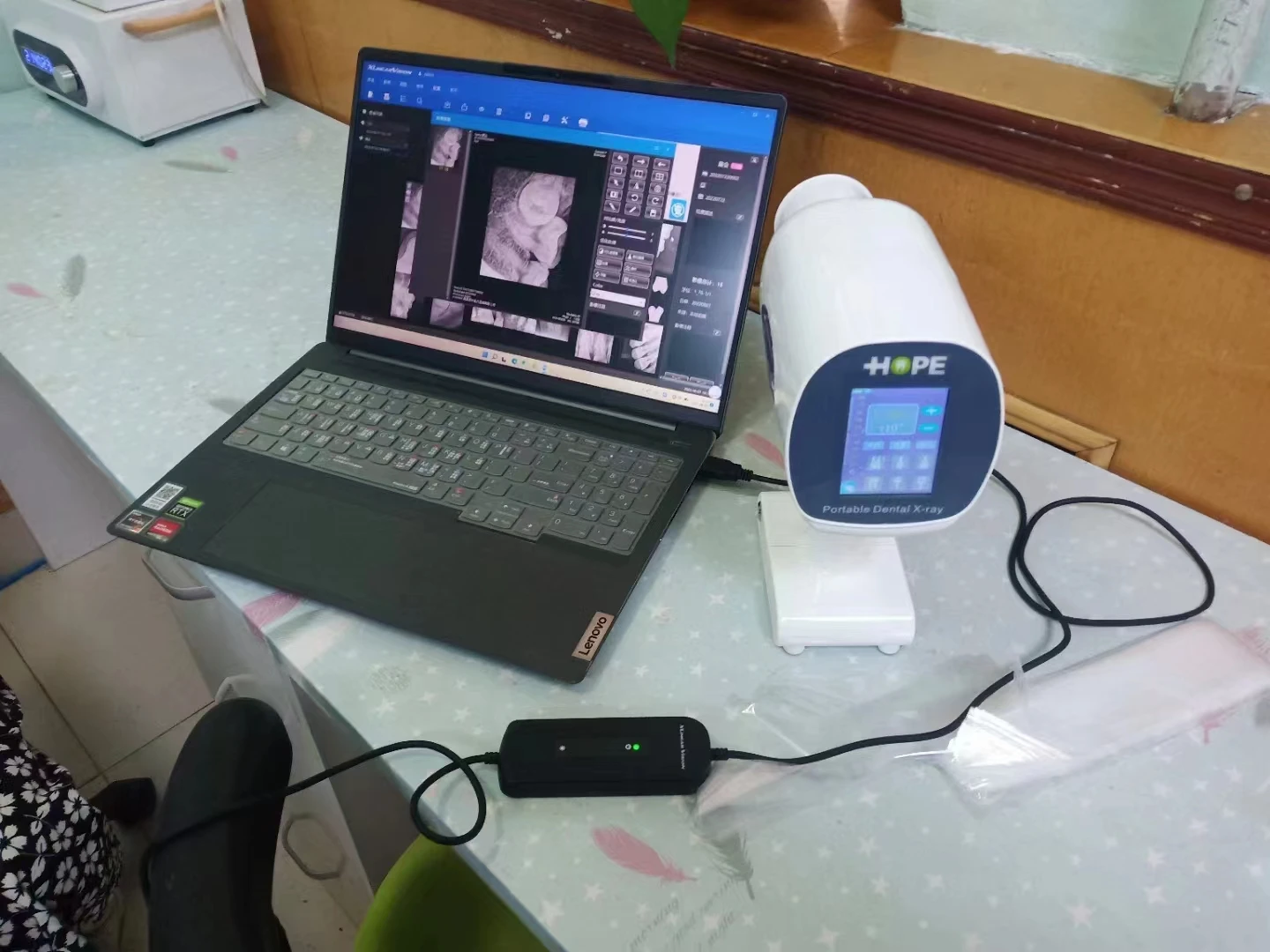 Portable Digital Mobile Dental X-ray Machine 360 Degree View Portable Dental X Ray