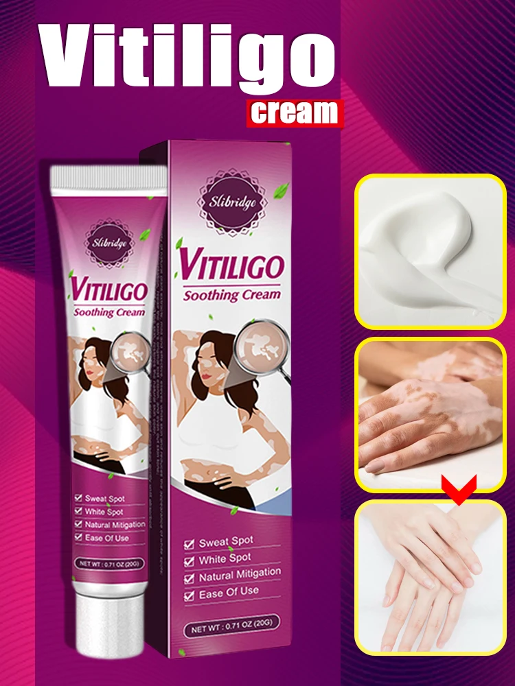 Traitement efficace de la crème de dessalement du vitiligo, produits de tache blanche