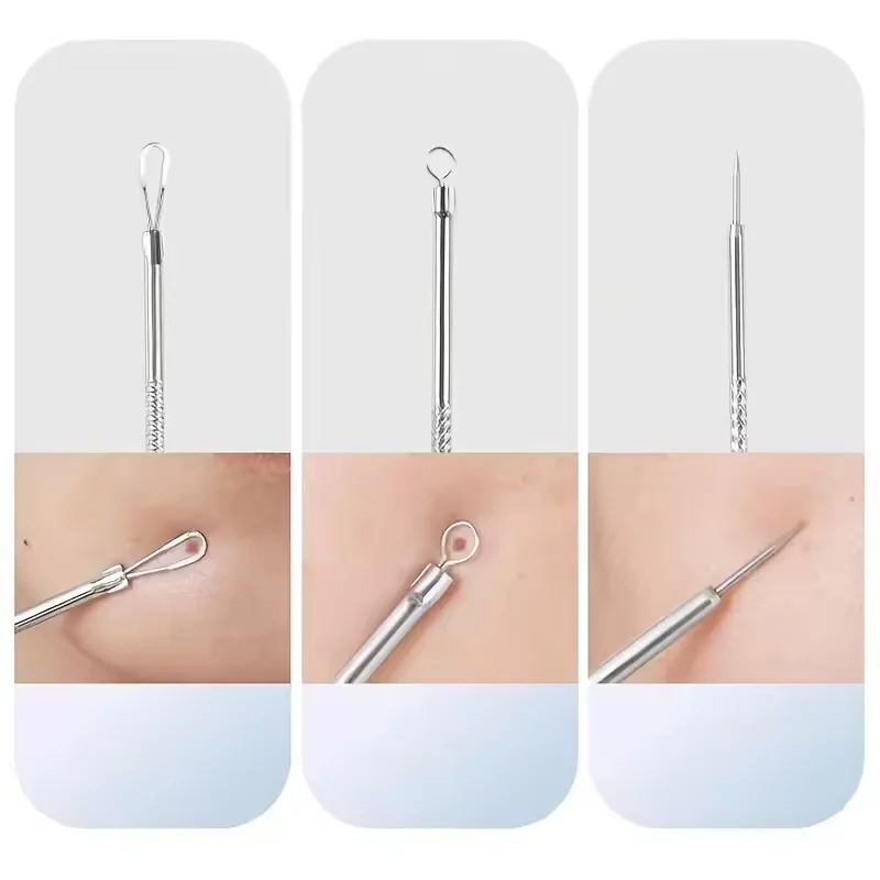 Stainless steel Acne Blemish Remover Blackhead Extractor Black Dots Cleaner Needles Set Black Spots Pore Cleanser Tool Acne