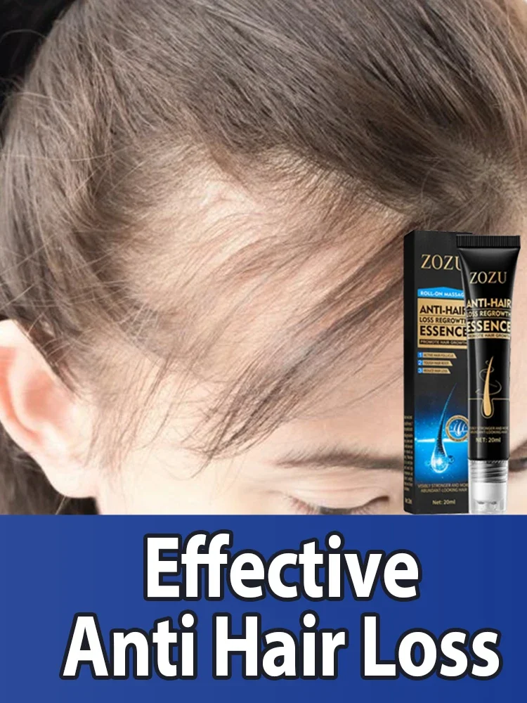 Fast Hair Growth Essence Effective Anti Hair Loss Serum Repair Hereditary Postpartum Seborrheic Hair Loss