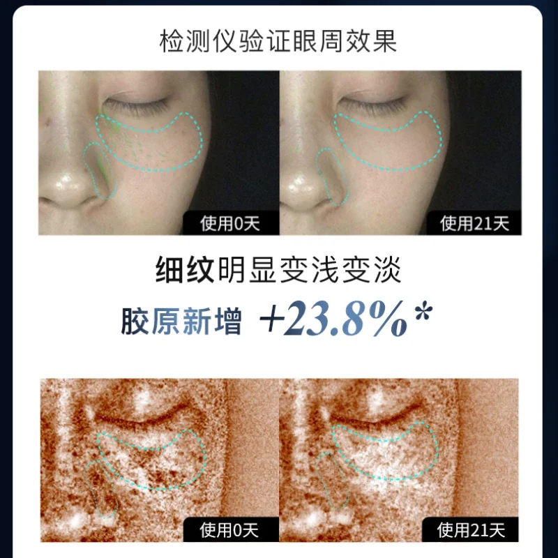 Gratis Verzending Eye Verfraaiing Instrument Eye Lifting Licht Lijnen Verstevigende Oog Schoonheid Anti-Aging