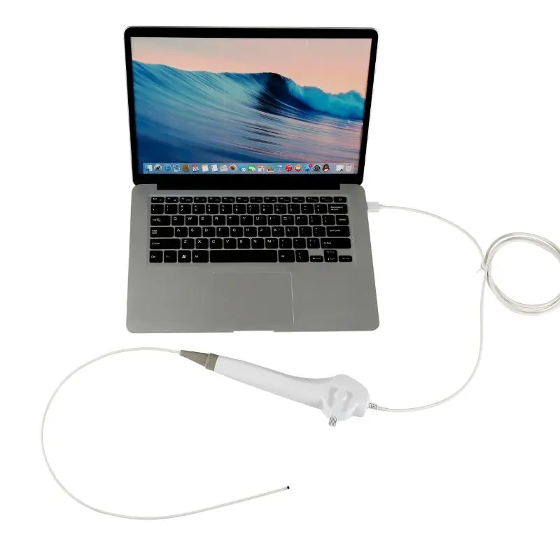 Nasolaringoscopio monouso nasofharyngoscopio video flessibile da 3,0 mm con cavo USB per otolaringologia