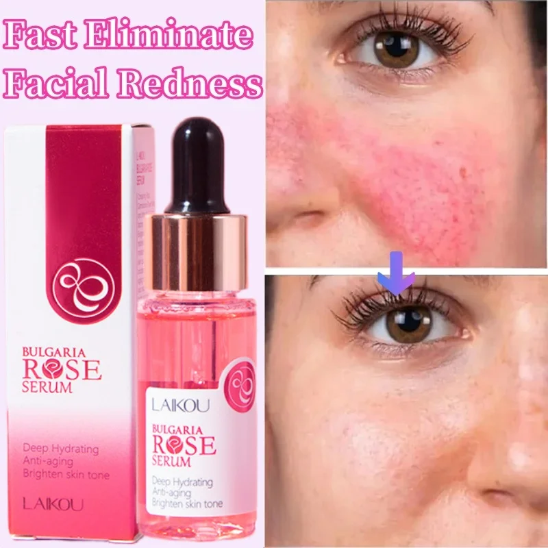 Facial Redness Repair Serum Against Redness Rosacea Spider Vein Treatment Sensitive Skin Shrink Pore Korean Face Skin Care Cream