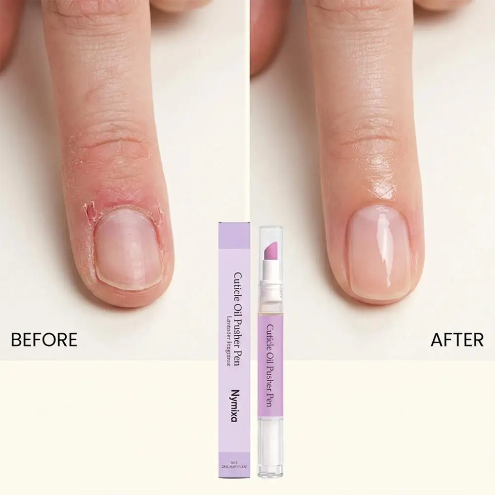 Nail Cuticle Oil Pen Nail Strengthener Nourishment Cuticle Remover Relieve Damaged Weak Prevent Agnail Nail Nutrition Oil Pen