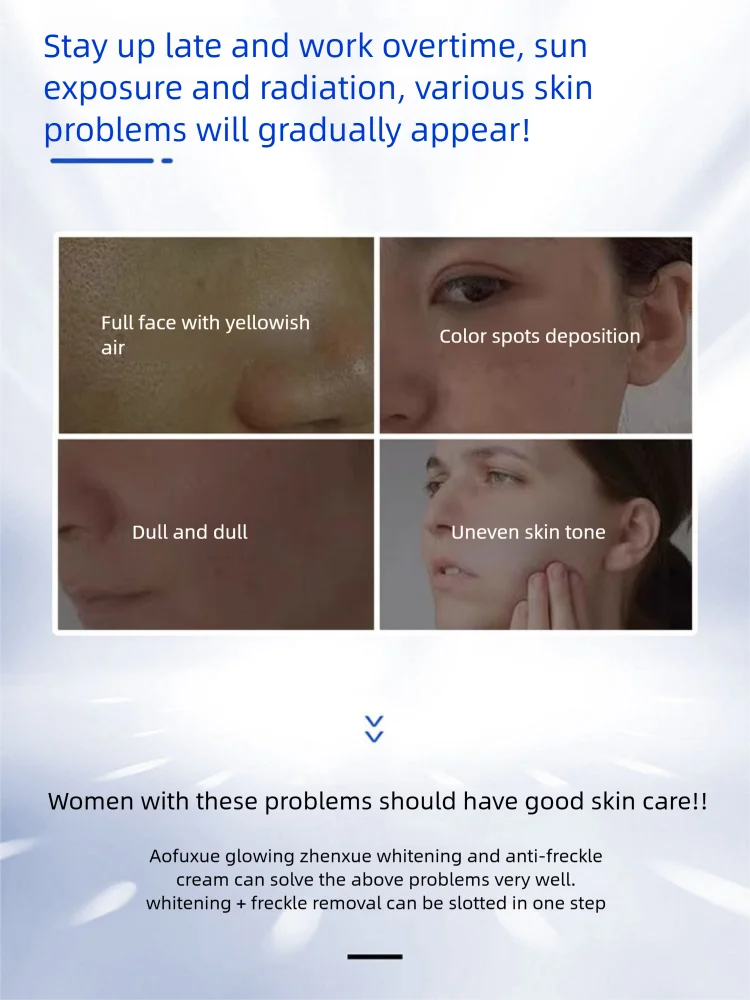 كريم تبييض النمش يزيل الكلف البقع الداكنة مصحح تفتيح تصبغ الميلانين تفتيح البشرة