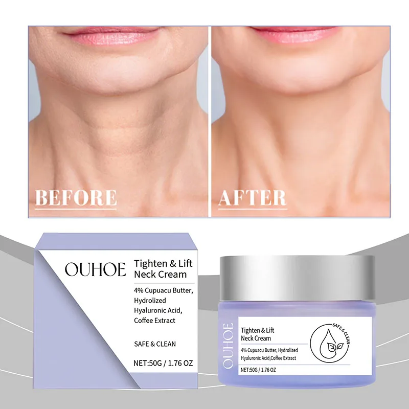 

Интенсивный крем для шейки матки Опреснение тонкой светлой мышцы питает крем для шейки матки Яркий увлажняющий крем для шейки 50 г