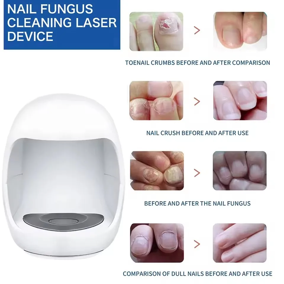

Nail Fungus Laser Treatment Device Repair Toenail Fingernail Fungus Treat Onychomycosis Laser Nails with Mushrooms Remove