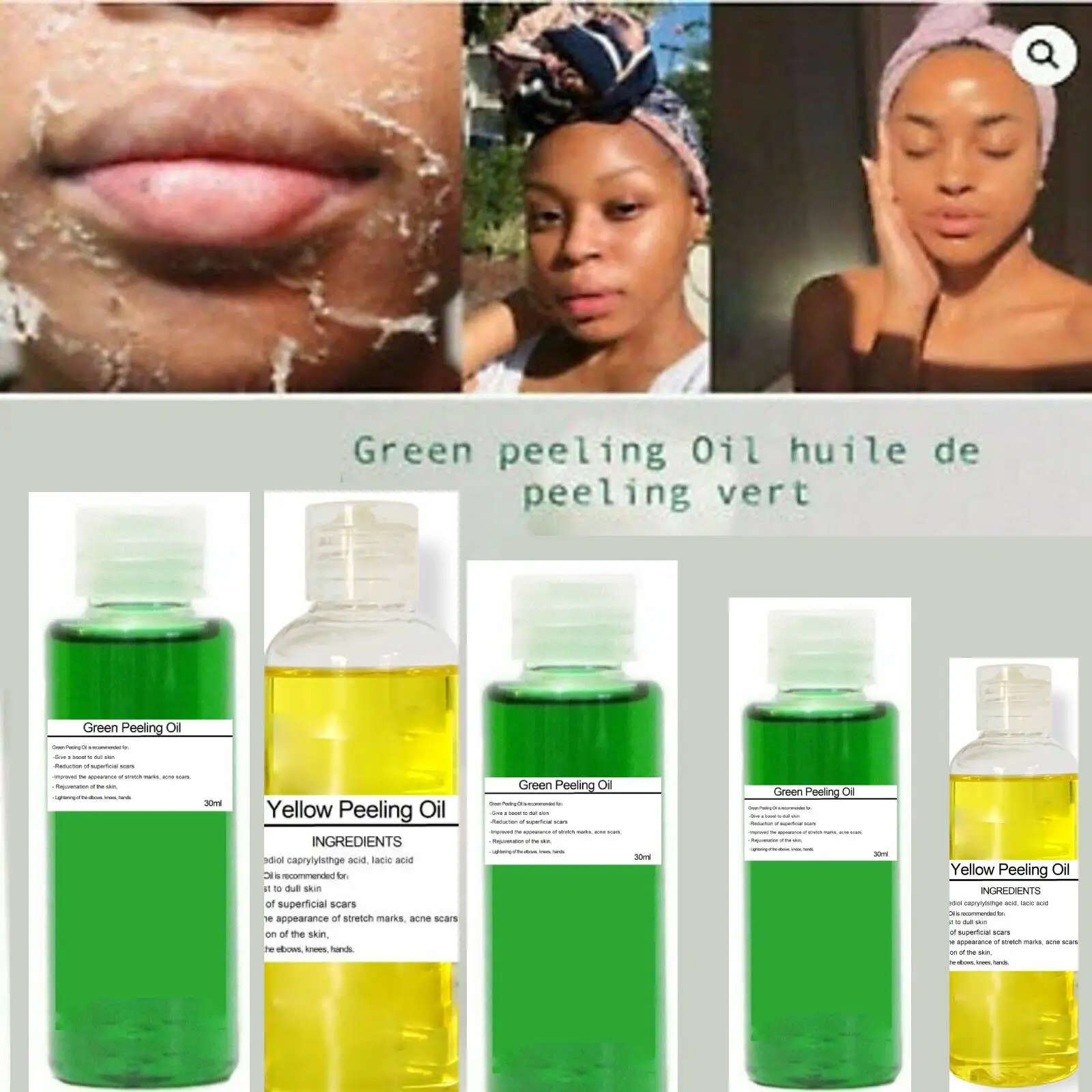 Exceptional green peeling oil-Huile de peeling green xtra strong 30 ml- show original title