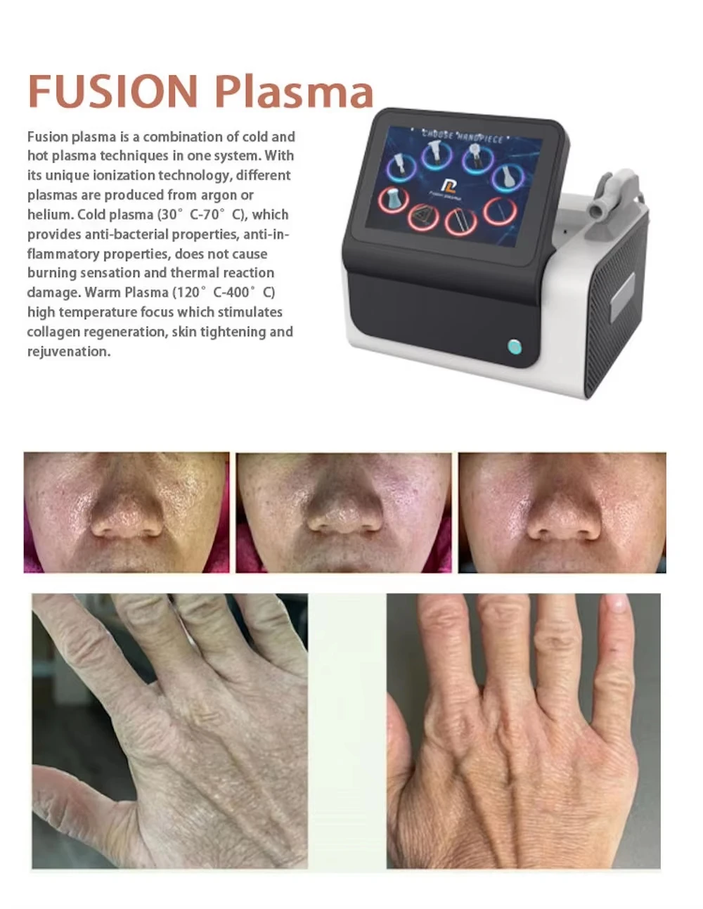 Dispositivo di Bellezza a Ioni - Skincare Ls recensione e prezzo