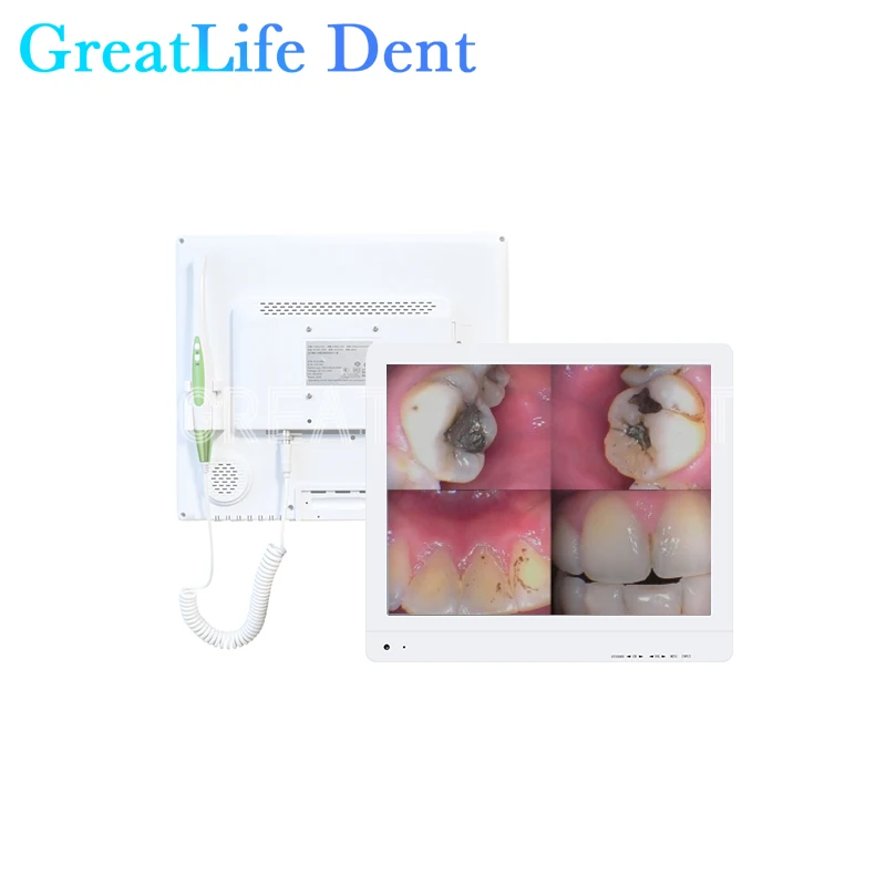 GreatLife Dent 17-дюймовая HD1600 10-дюймовая стандартная холодная стандартная стоматологическая Usb Проводная внутриоральная интраоральная камера Wi-Fi беспроводная