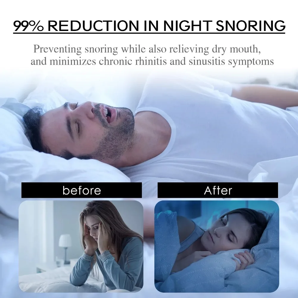 Stop Snoring Patch Nose Breathing Correction Improve Sleeping Promoting Better Breath Portable Night Sleep Mouth Orthosis Tape