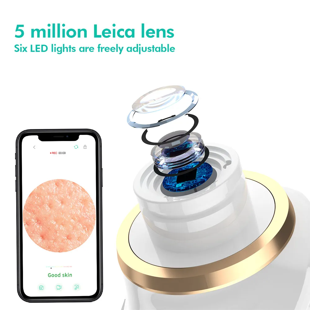 เครื่องมือกําจัดสิวหัวดําพร้อมกล้อง เครื่องมือกําจัดสิวหัวดําบนใบหน้า เครื่องมือกําจัดสิวหัวดําจมูกลึกมืออาชีพ