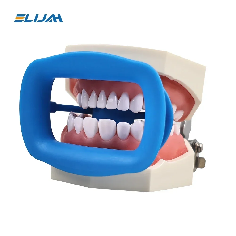 ELIJAH 1 قطعة الأسنان لينة السيليكون ثلاثية الأبعاد الشفاه الخد ضام الفم فتاحة الخد توسيع المواد الاستهلاكية تقويم الأسنان 4 اللون المتاحة #2