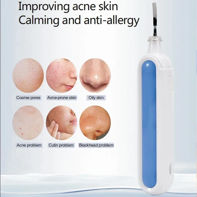 Limpiador ultrasónico de piel, eliminador de espinillas, limpieza Facial profunda, limpiador ultrasónico de iones de acné y poros, pala Facial