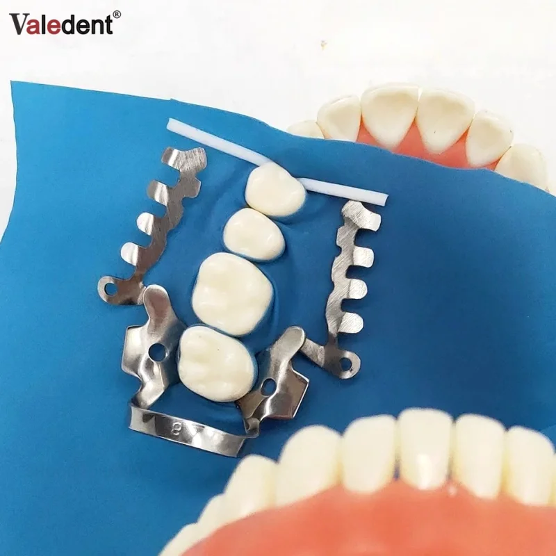 

10 шт., стоматологический многофункциональный зажим для резиновой плотины, специальные зажимы для стоматологии, зажимы из нержавеющей стали, орто материал для стоматолога, инструмент
