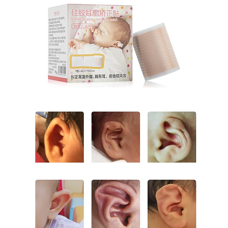 Baby Ear Corrector Cuttable Breathable Infant Toddler Auricle Valgus Silicone Correction Patch with Ear Support Patches