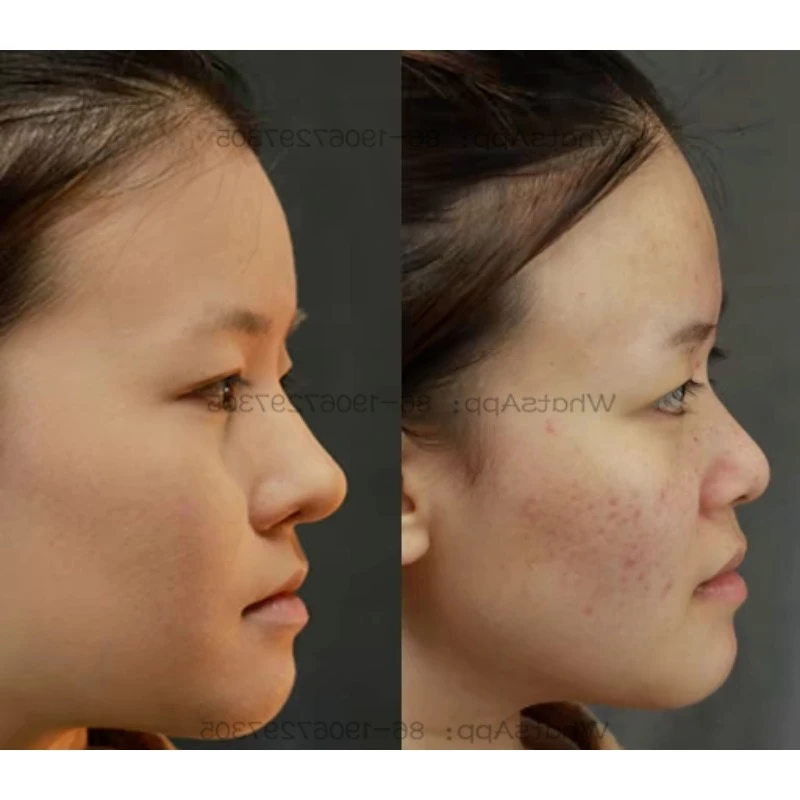 Silicone False Nose Heightening Shaping Platinum Silicone Nose COS Out Into Men and Women
