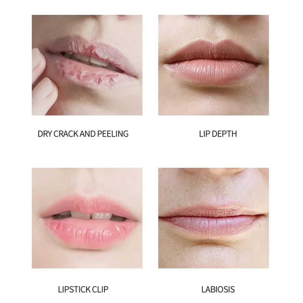 4 قطعة/المجموعة الفواكه أحمر الشفاه مجموعات ترطيب الشفاه بلسم كيت البرتقال العنب الألوة الفراولة ترطيب الشفاه العناية بالبشرة #6