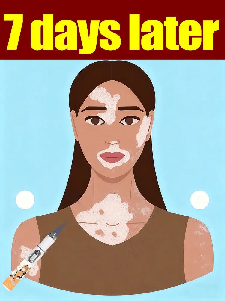 

The latest product is the blue light pen for Vitiligo and a Body care tool.