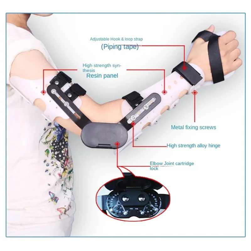 Adjustable upper limb orthoses forearm arm wrist elbow fracture fixed with a stent gear splint