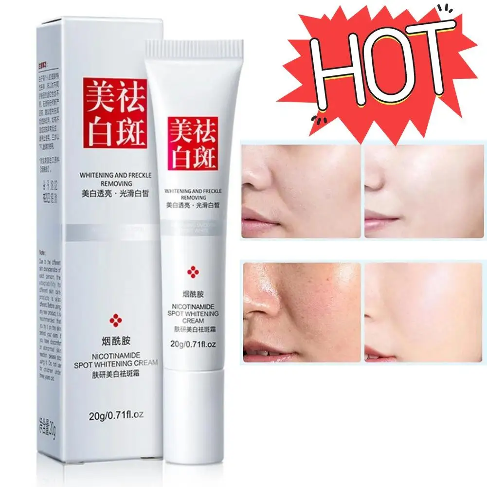 Whitening Cream For Face Spots Remove Dark Spot Melasma Anti-Pigmentation Improve Dullness Brighten Face Skin Care Cream