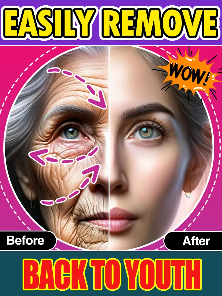

Laser products, wrinkles disappear, restore youth