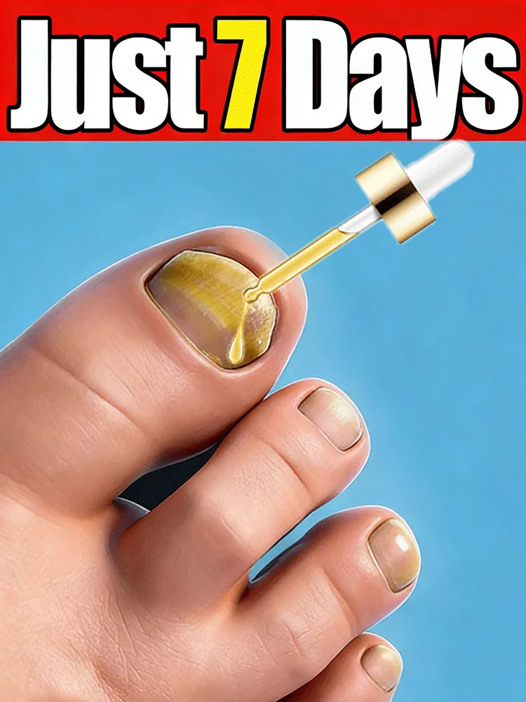 

2026Новый продукт для поддержки здоровья ногтей