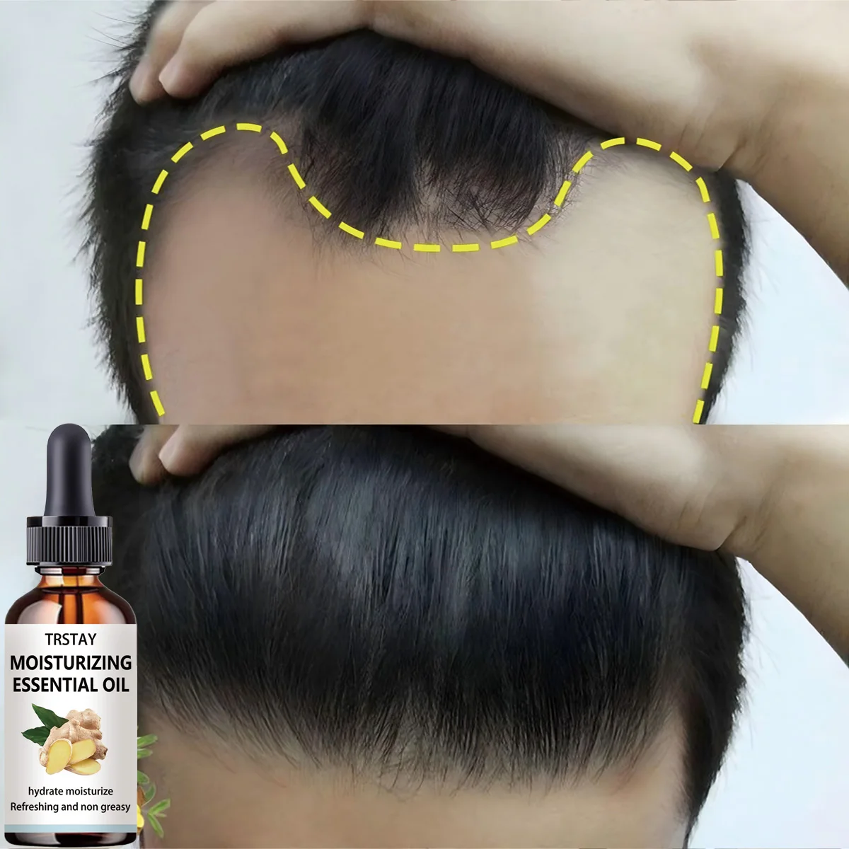 

Продукты для роста волос имбирное быстрорастущее эфирное масло для волос красота уход за волосами Предотвращение выпадения волос масло для ухода за кожей головы для мужчин женщин и мужчин