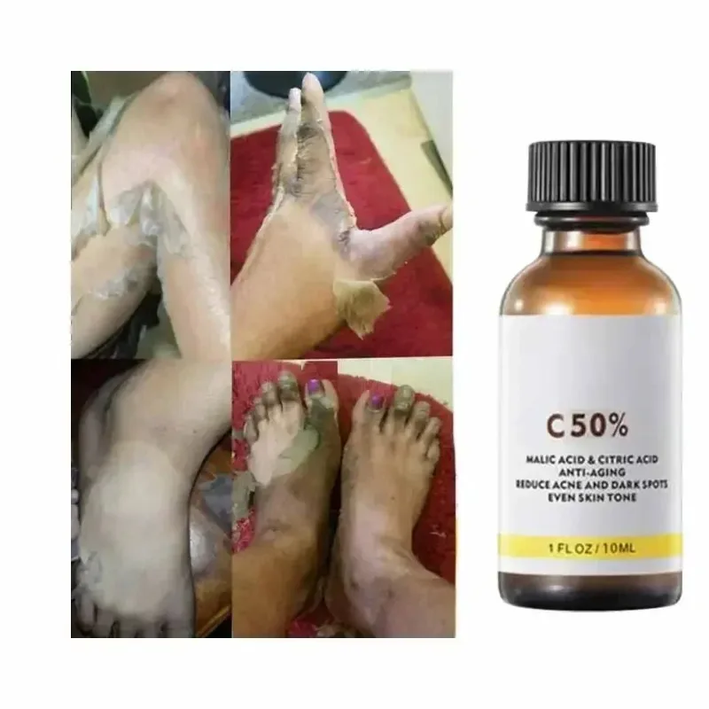 Thumbnail 4 - #45 Best Acne Treatments & Kits to Buy In 2026