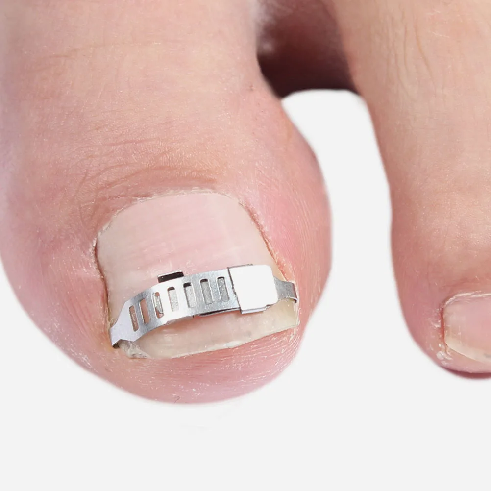 

1 set 1 Set Ingrown Tool Pedicure Correction Kit Nail Inlay Corrector For Healthy Toenail Care Toenail Brace Support