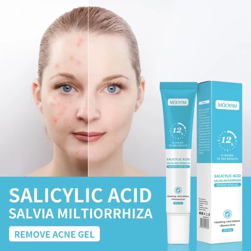 Salicylic Acid Acne Treatment Cream Fades Acne Marks Acne Closure Pore Shrinking Plant Essence Gel Facial Care Before Make-up