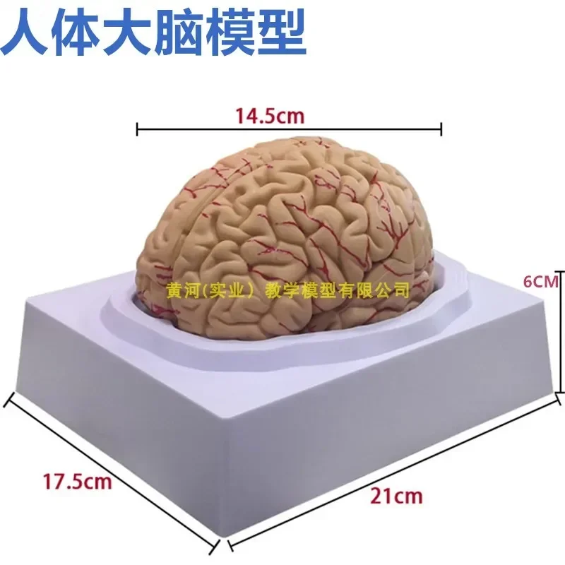 A Teaching Model Of Medical Cerebrovascular Cerebrovascular Neurology Brain Artery Vascular Skull Base Human Brain Structure