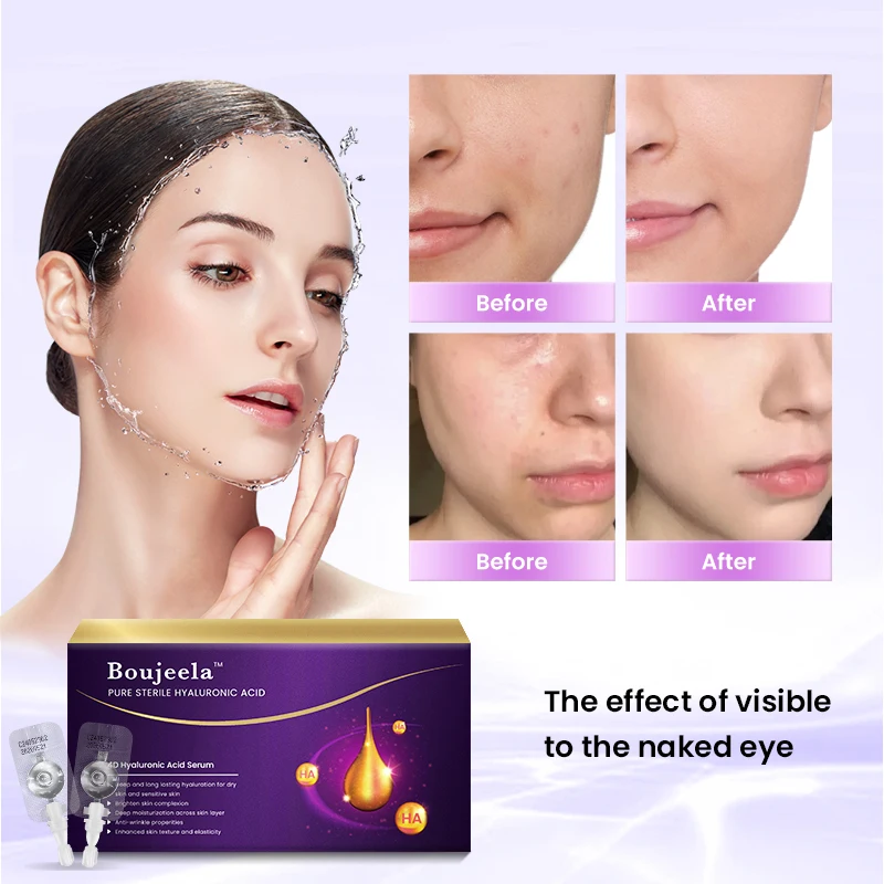 10pcs PURE 4D Hyaluronic Acid Facial Serum Anti Aging ริ้วรอยปราศจากเชื้อแคปซูล Ampoule Skin Care Whitening Moisturizing Essence