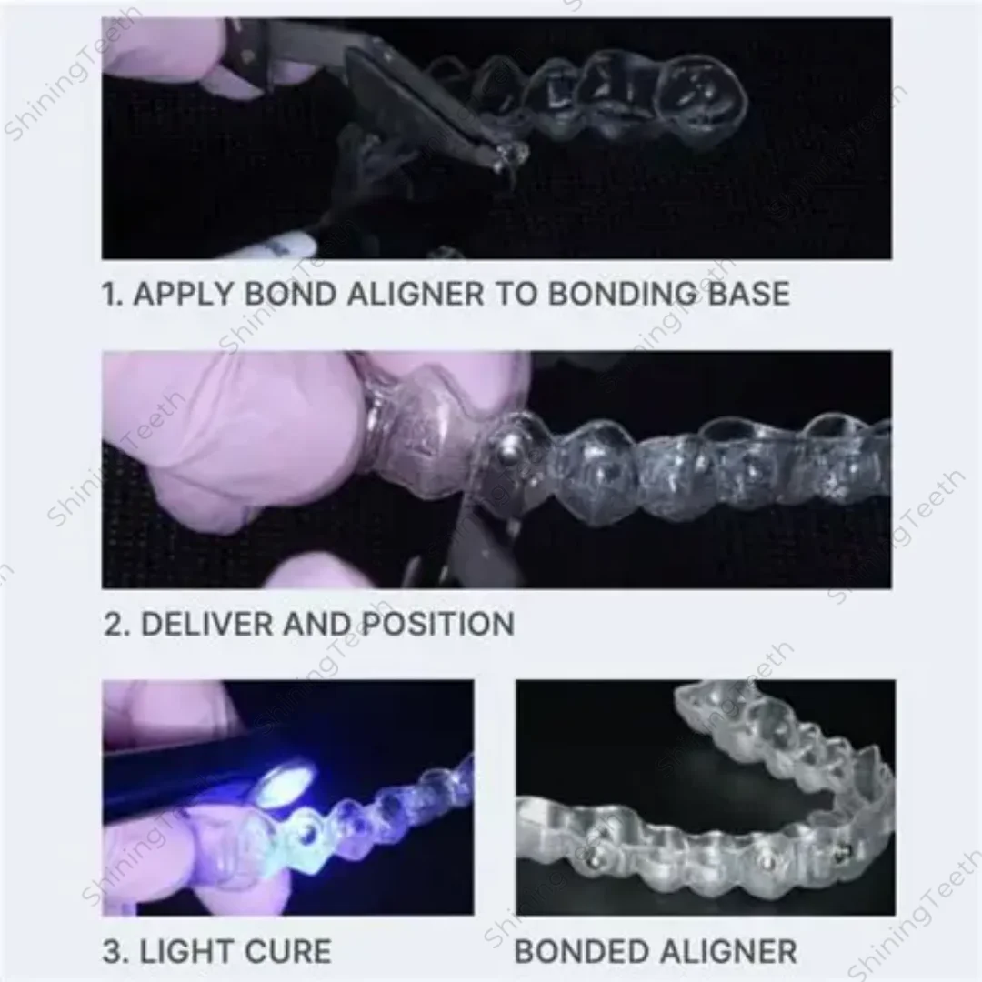 Dental Light Cure Orthodontic Adhesive Paste for Bond Clear Aligner Attachments 2.5g - Image 2