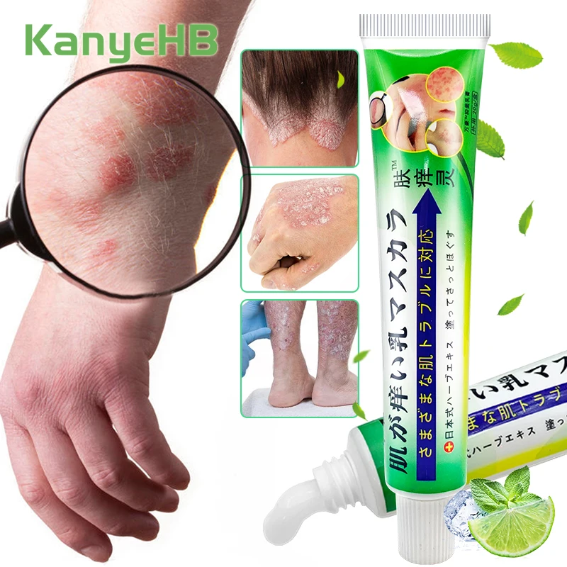 1Pcs Psoriasis Ointment Eczma Rash Cream Work Perfect For Skin Problems Cream Antipruritic Medical Beauty-Health Plaster S111