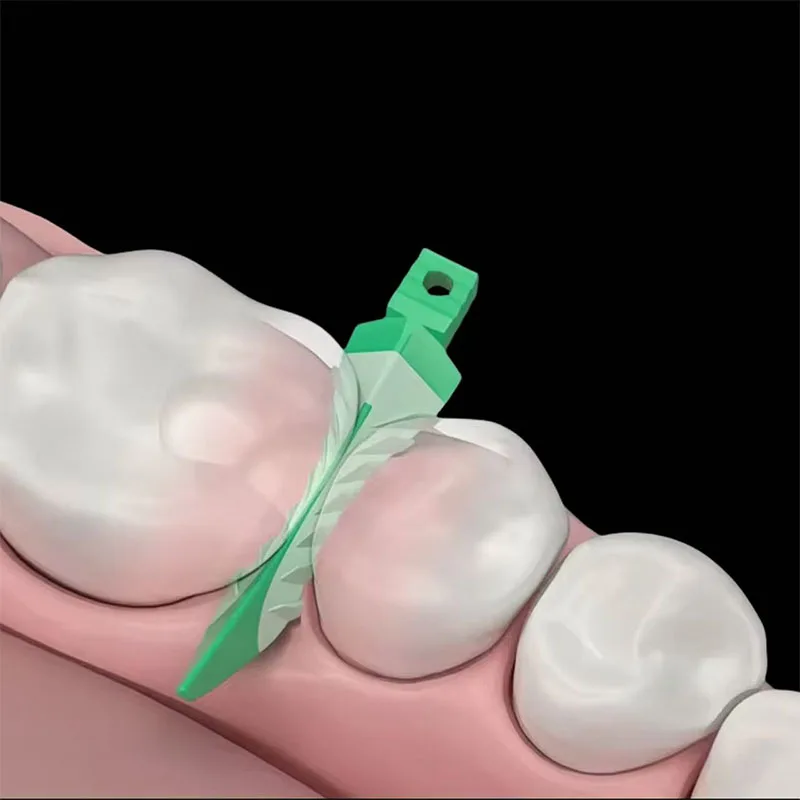 Dental Interdentalkeile Versiegelung Verbundkeile Silikon Geeignet Adaptive ES/S/M/L Zahnarztmaterialien für die Zahnrestaurierung – Detail 4