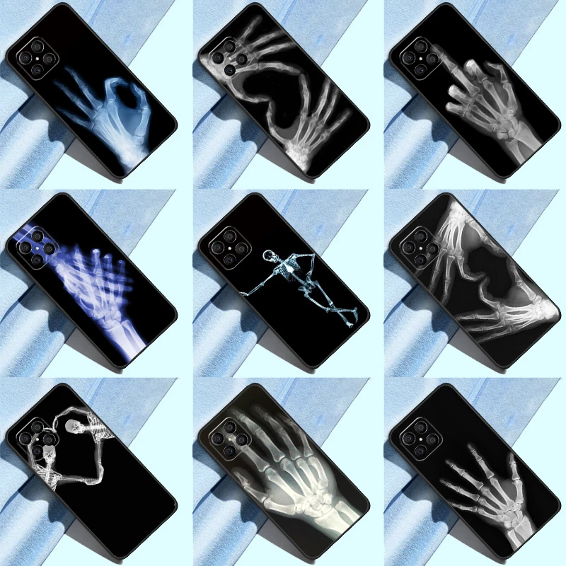 X-ray Hand Bones Case For Huawei Honor 50 70 X7 X8 X9 P50 P30 Pro P20 P40 Lite Nova 9 P Smart 2019 Cover