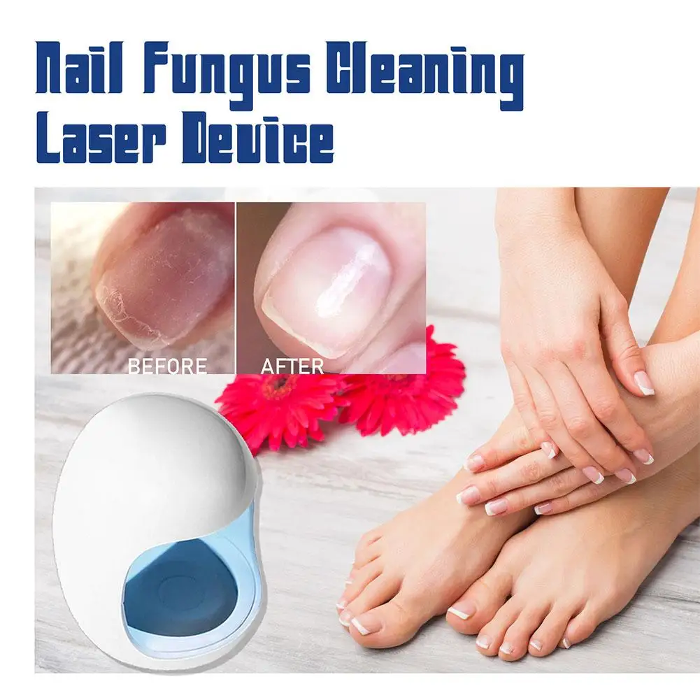 Dispositivo de tratamento a laser para fungos nas unhas, reparação de fungos nas unhas dos pés, tratamento de onicomicose, unhas a laser com relaxamento de cogumelos