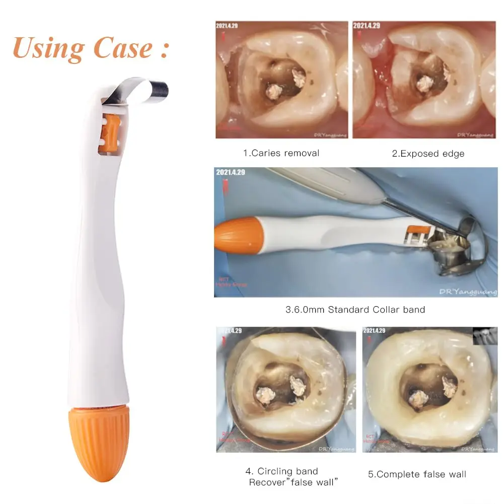 Bandes de matrice dentaire Pro, 10 pièces, système de Matrices métalliques interproximales, anneau de matrice réglable pour la restauration molaire/Premolaire