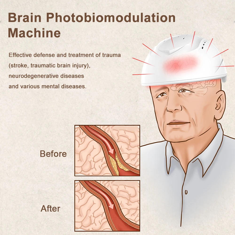 Рисунок 3 - Шлем PBM Neuromodulacion Brain