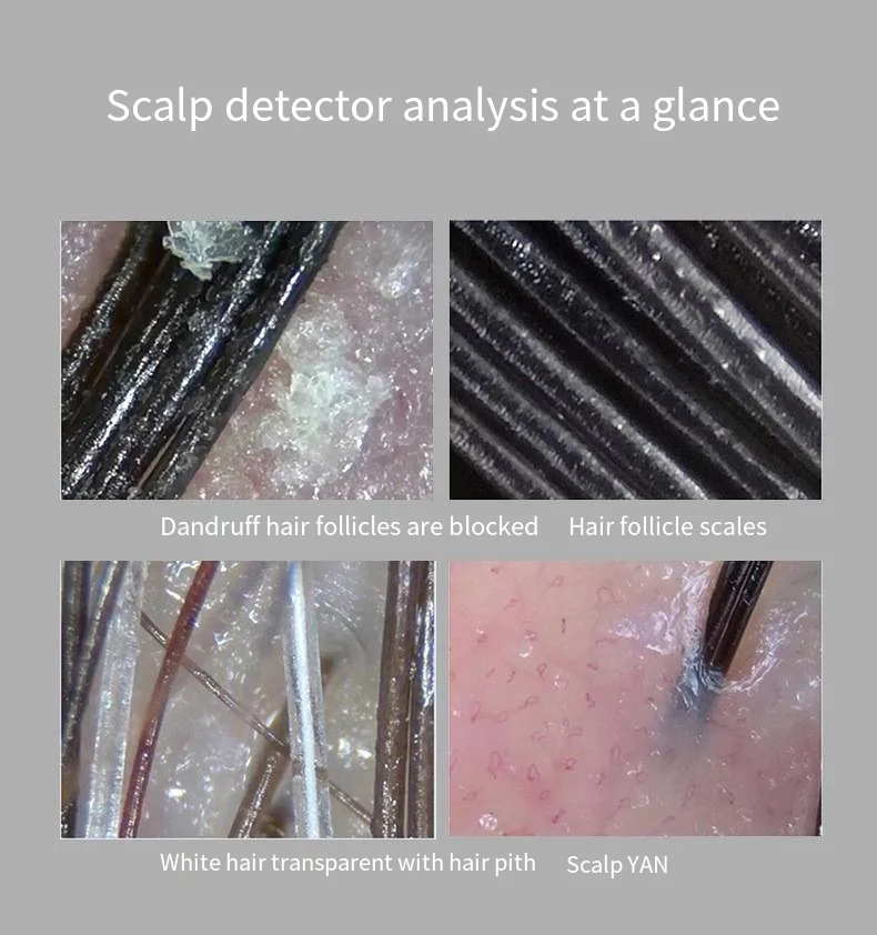 Handheld Derma toskop Haut analysator Maschine USB Kopfhaut Diagnose gerät Mikroskop zum Löten Gesichts-und Körper analysator Schönheit