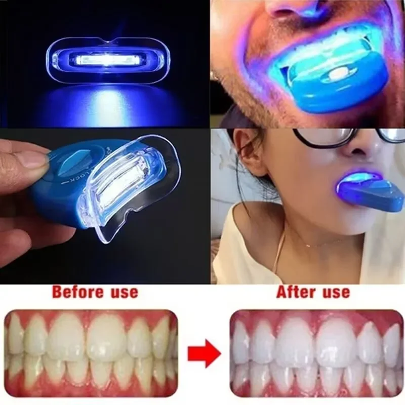 Perawatan Penyakit Gusi Starlite Smile, Perawatan Periodontal Perawatan Mulut Terapi Cahaya Merah Mempromosikan Penyembuhan dan Pereda Nyeri
