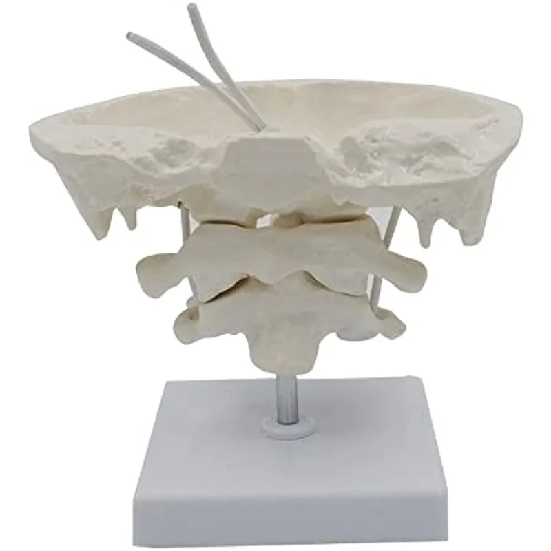 

1.5x Magnification Human Cervical Spine Occipital Bone Anatomy Model Medical Teaching Training Aid