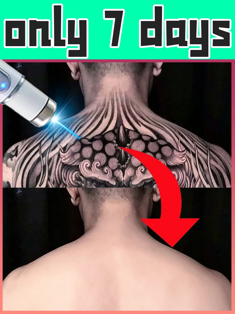 

ₜₐₜₜₒₒ ₗₐₛₑᵣ ₚₑₙ ₙₑwₗy ᵤₚgᵣₐdₑd ₜₒ ₜₕᵢᵣd gₑₙₑᵣₐₜᵢₒₙ ᵦₗᵤₑ ₗᵢgₕₜ