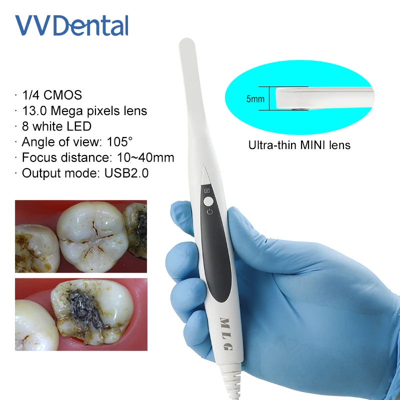 4K HD Oral Camera 5mm Ultra-slim MINI Lens CMOS 13.0 Mega Pixels 8LED USB Tooth Endoscope Auto-focus Oral Exam Device