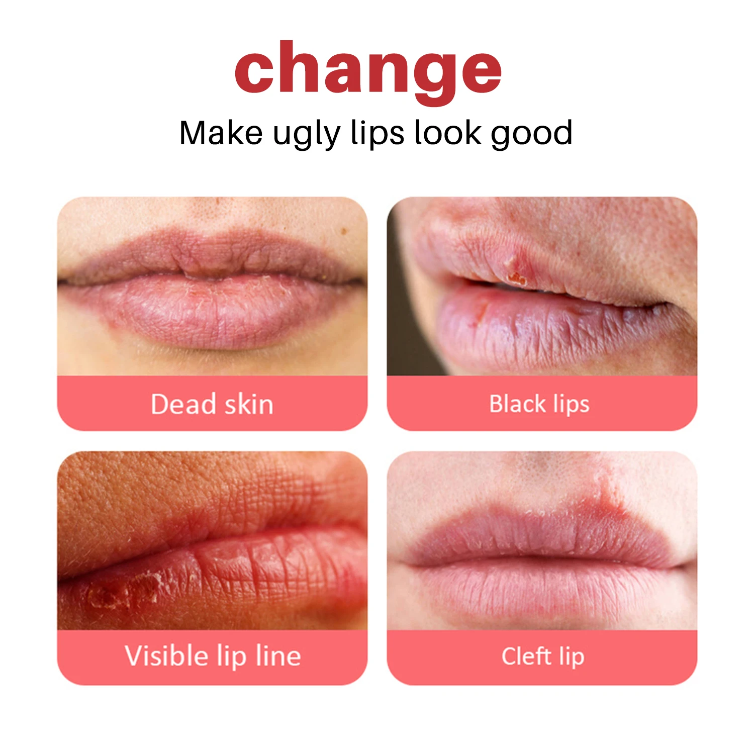 Lip Balm For Remove Dark Lip Moisturizing Lightening Melanin Whitening Plumper Extreme Gloss Pink Lips Skin Care For Men Women