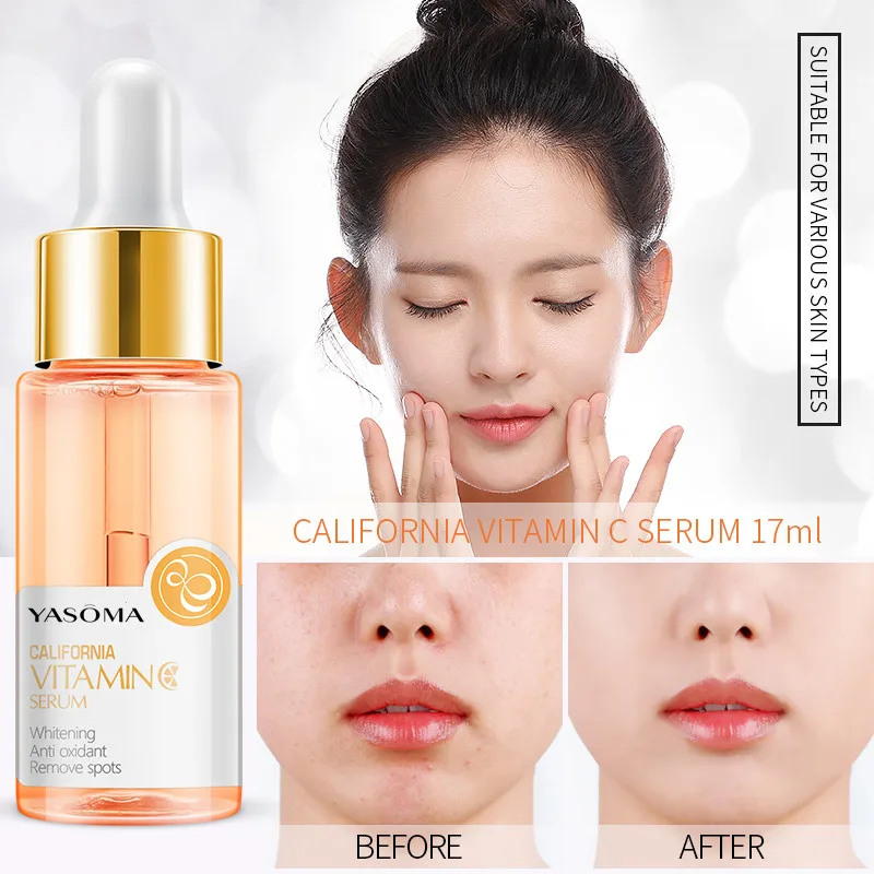 

YASOMA Vitamin C Whitening Facial Serum Remove Dark Circles Fade Freckles Spots Melanin Moisturizing Brightening Face Essence