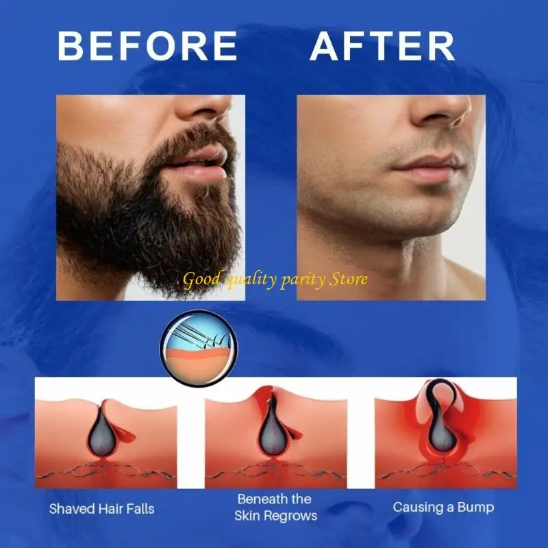 

M4YA Men Shavers Bumps Solution for Face Legs Body 100ml Shavers Bumps Treatments After Shave Water Ingrown Hair Treatments