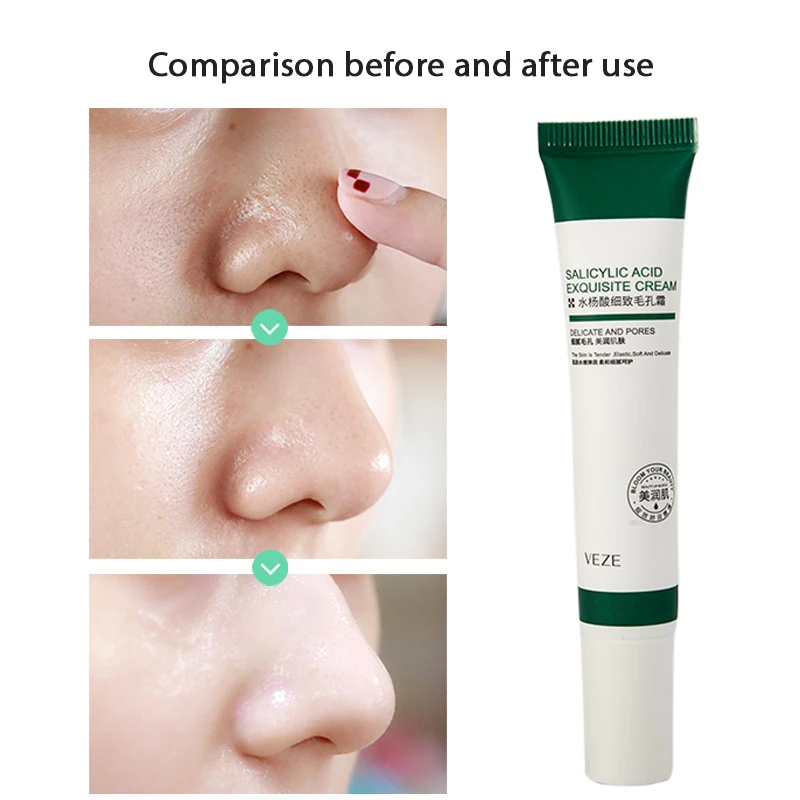 Salicylic Shrink Pore Cream Improve Acnes Blackheads Whitening Anti-aging